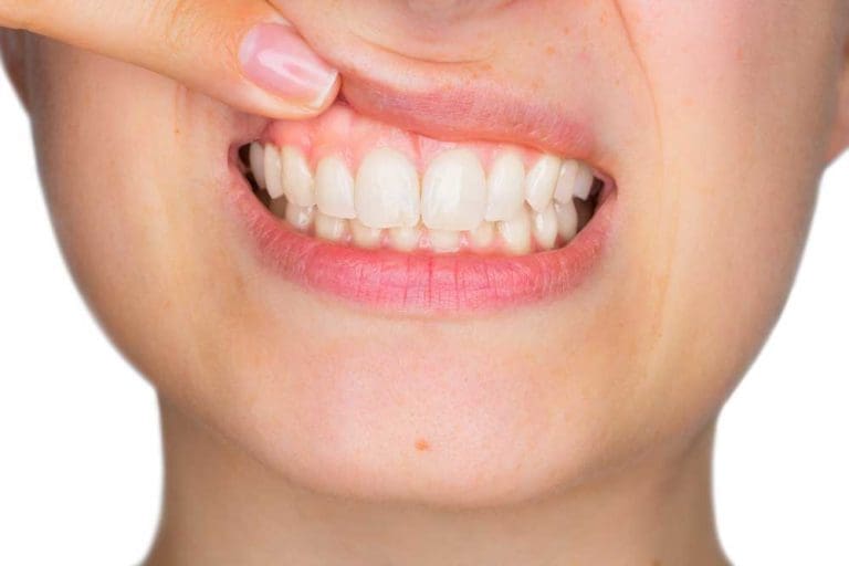 dental patient with gum disease